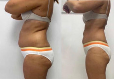 premena1
